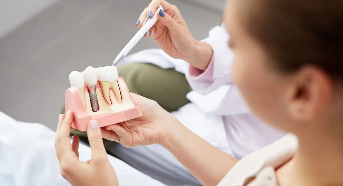 10 Frequently Asked Questions About Dental Implants